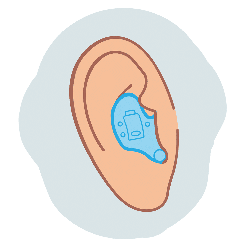 Traditional in-the-ear (ITE) hearing aid