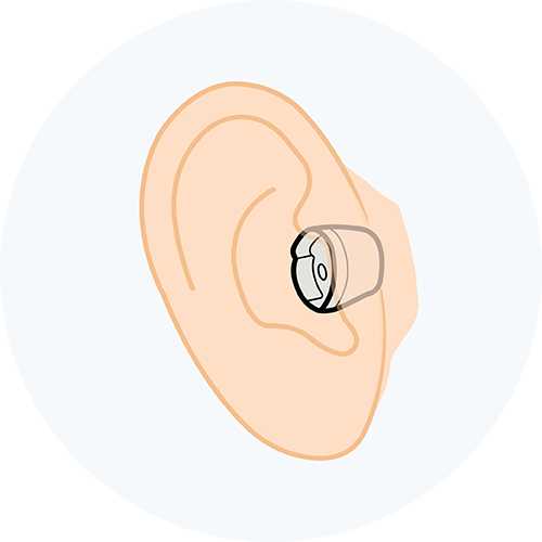 In-the-canal hearing aid illustration