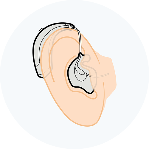 Behind-the-ear hearing aid illustration