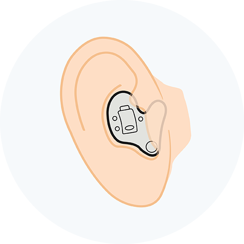 In-the-ear hearing aid illustration